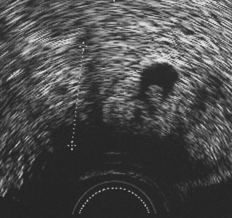 Ultraschall-Bild
