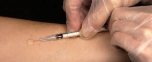 Impfen, Einstich in den Arm